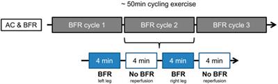 Impact of a Six-Week Prehabilitation With Blood-Flow Restriction Training on Pre- and Postoperative Skeletal Muscle Mass and Strength in Patients Receiving Primary Total Knee Arthroplasty